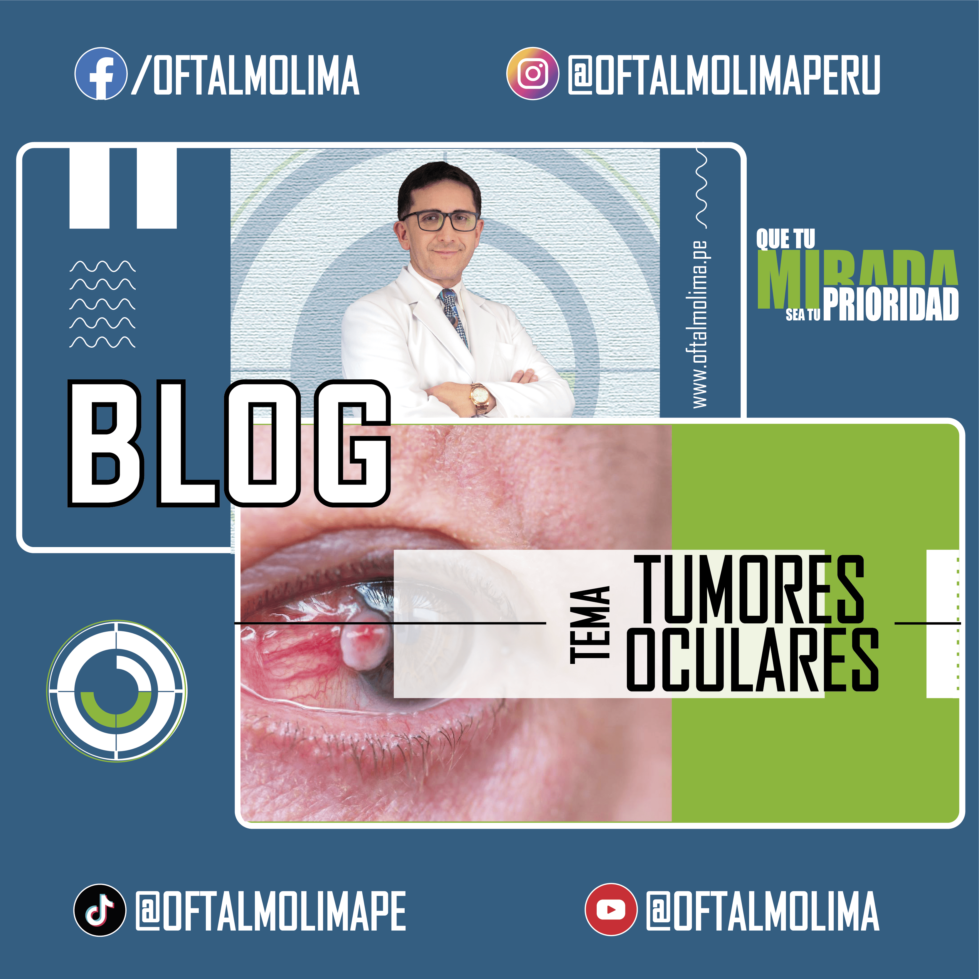 Tumores oculares