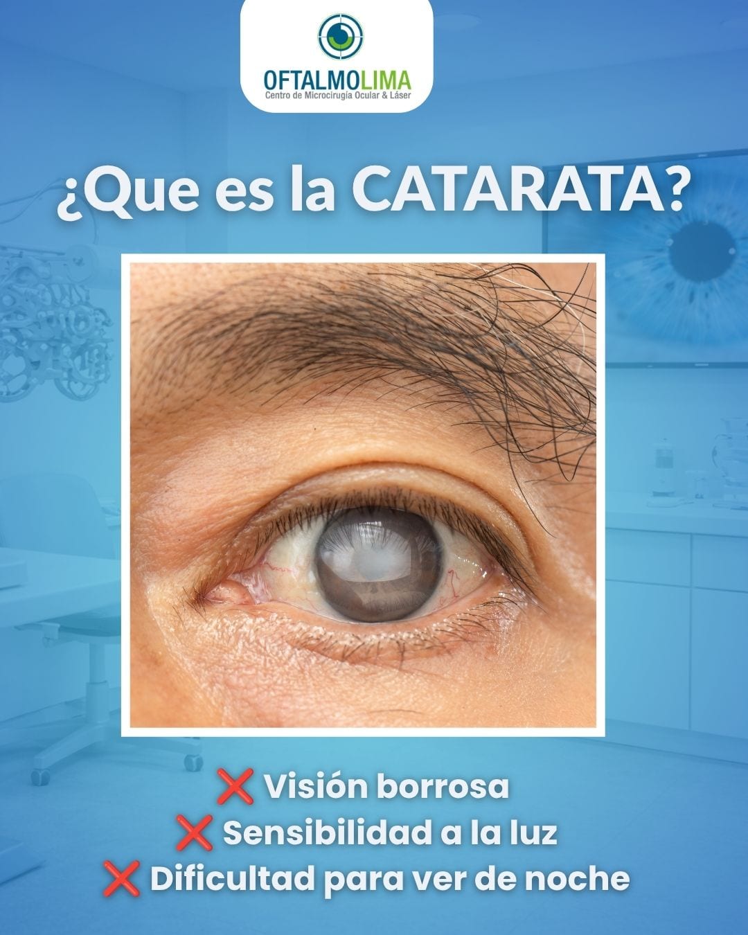 catarata