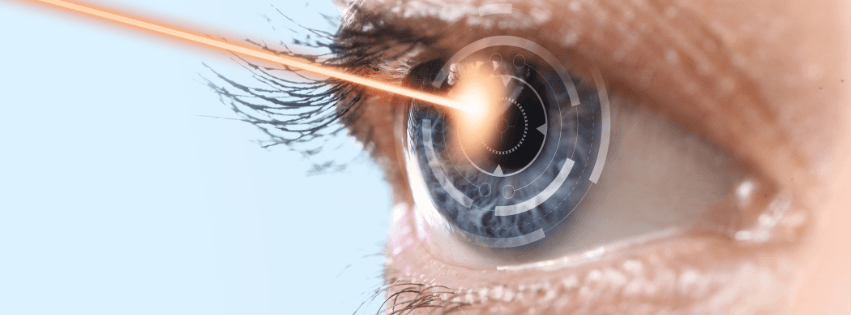 ¿Qué es una capsulotomía YAG láser?