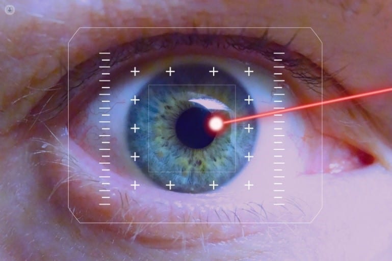 Cirugía Láser LASIK: Claridad Visual al Alcance de la Mano