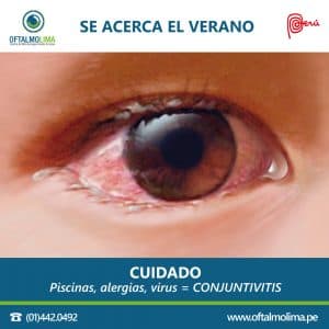 La conjuntivitis