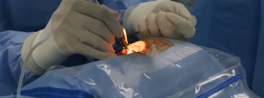 cirugia de chalazion