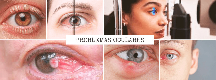 ¿Qué es una consulta oftalmológica?