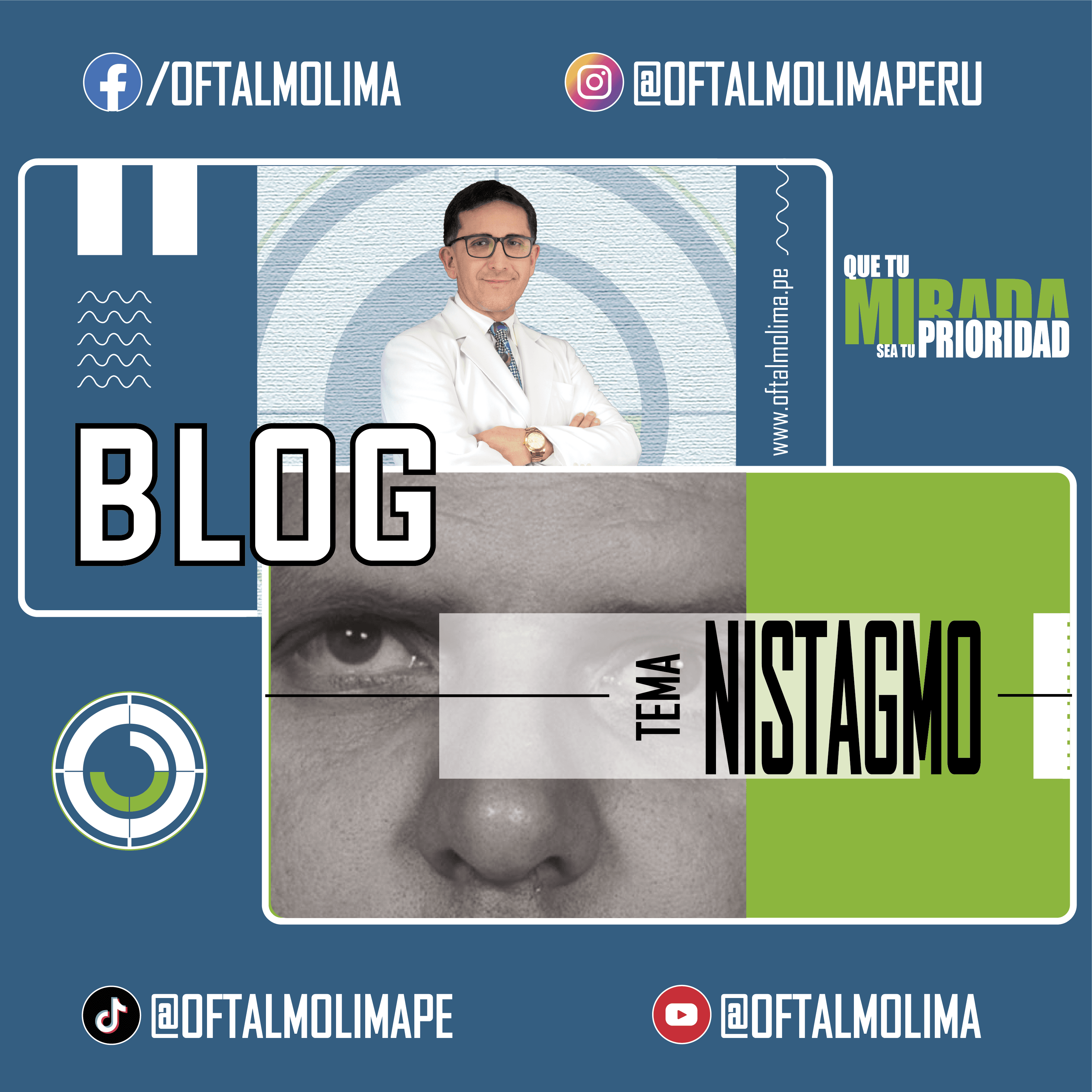 Nistagmo
