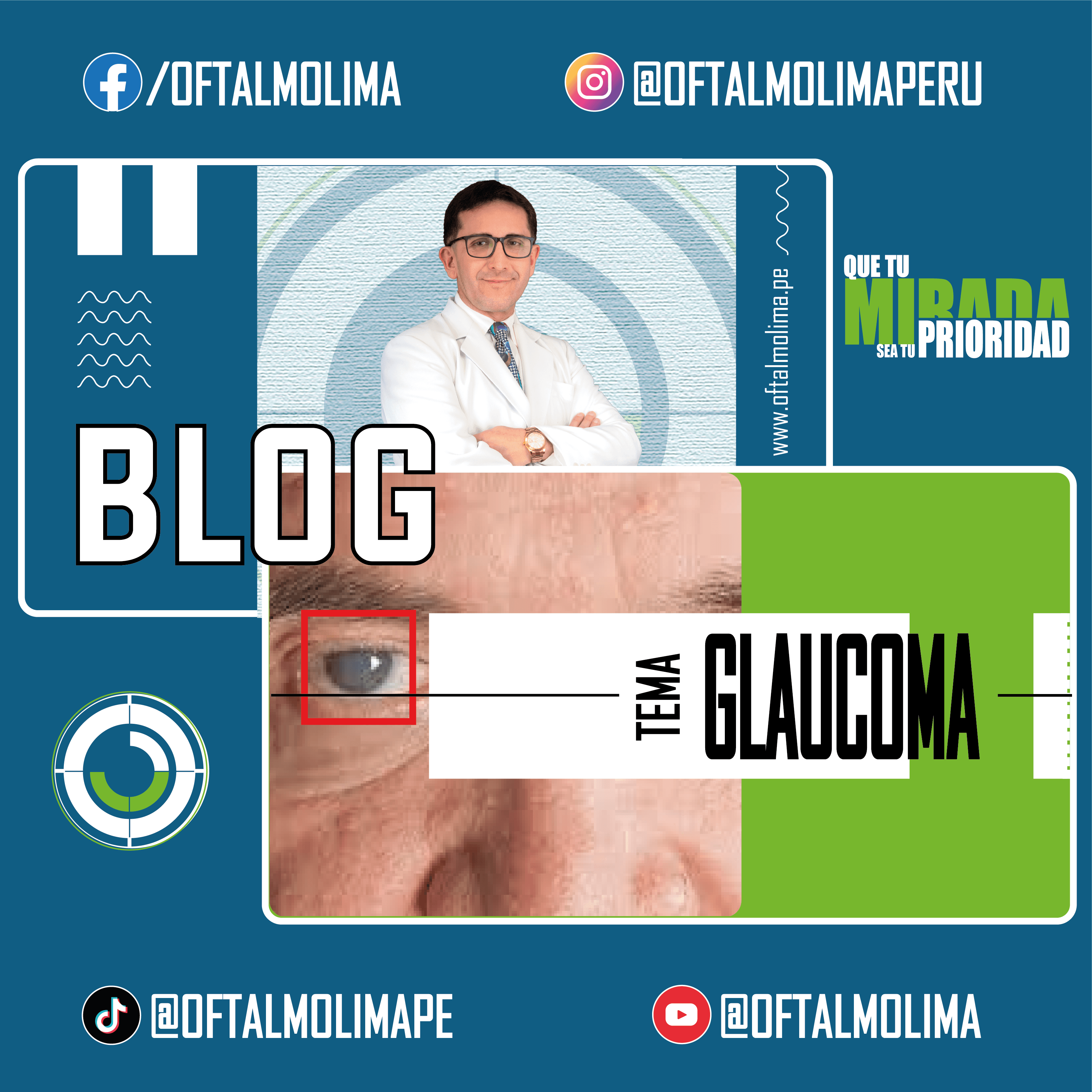 ¿Qué es el glaucoma?