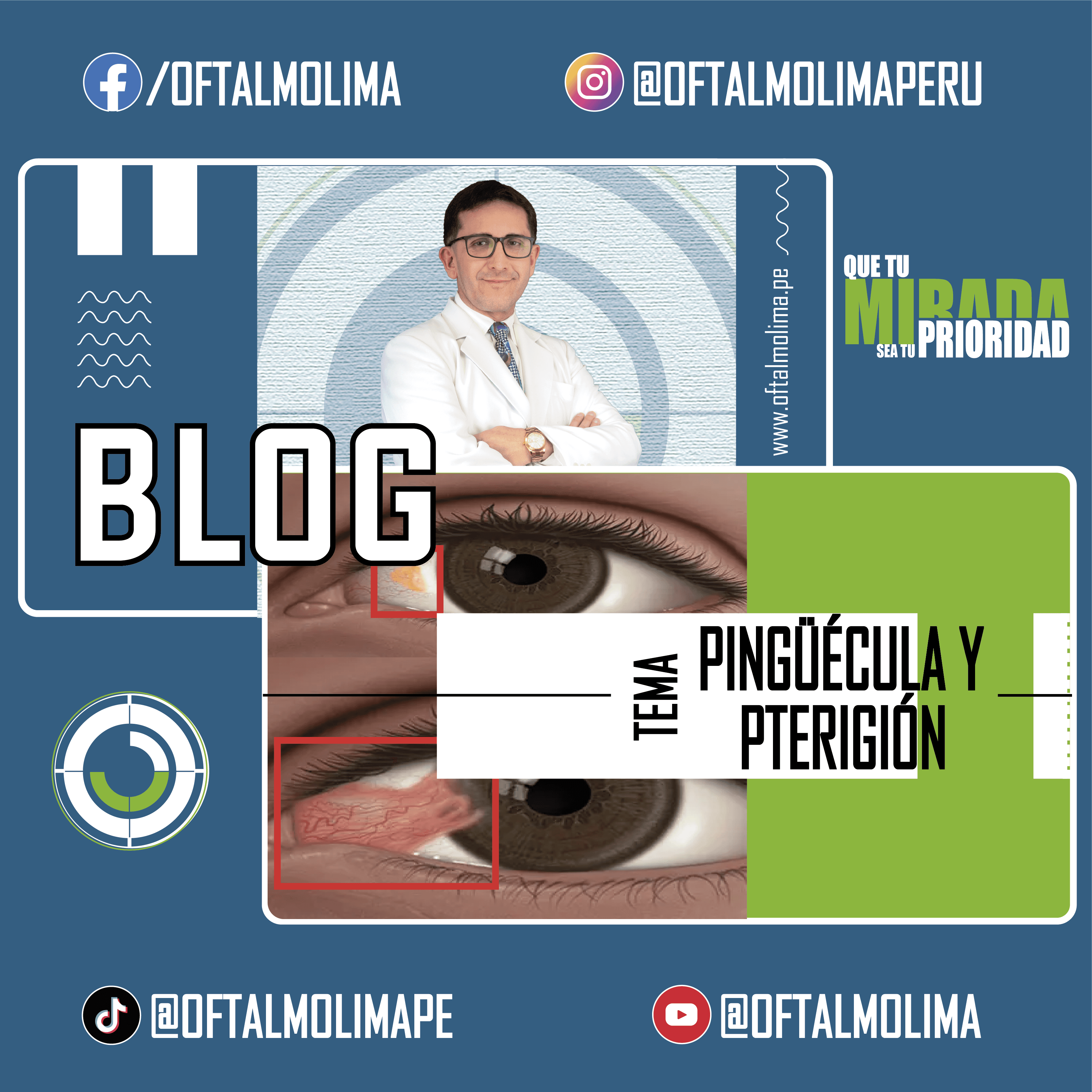 La Pingüécula y el pterigión