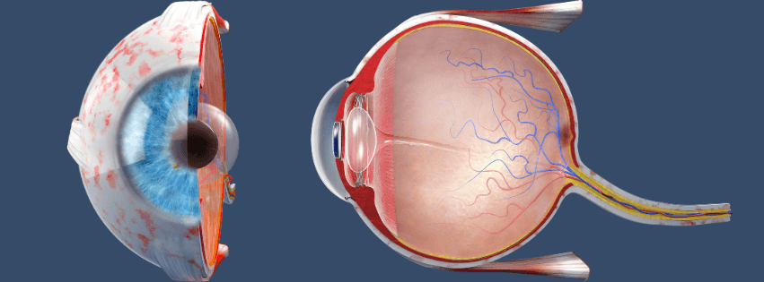 ¿Qué es la retinopatía diabética?