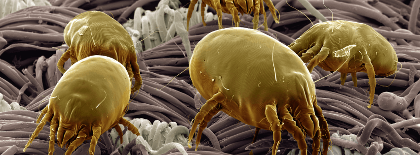 Demodex ocular