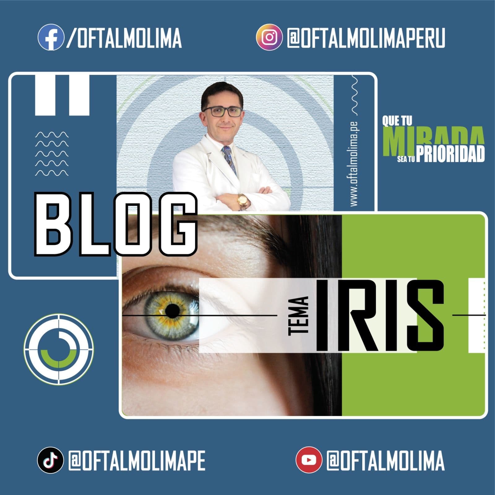 IRIS