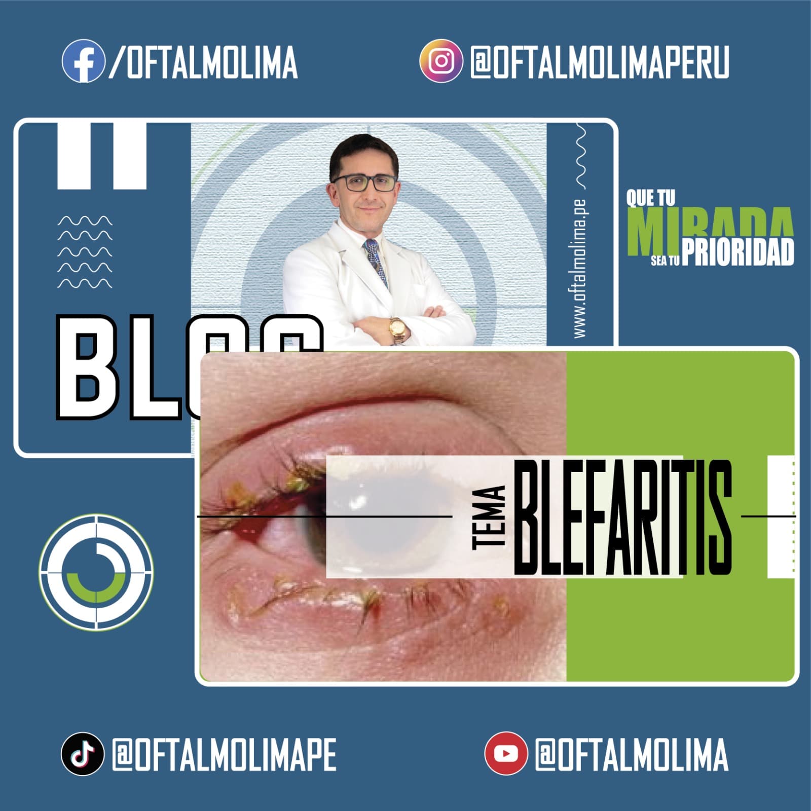 Blefaritis