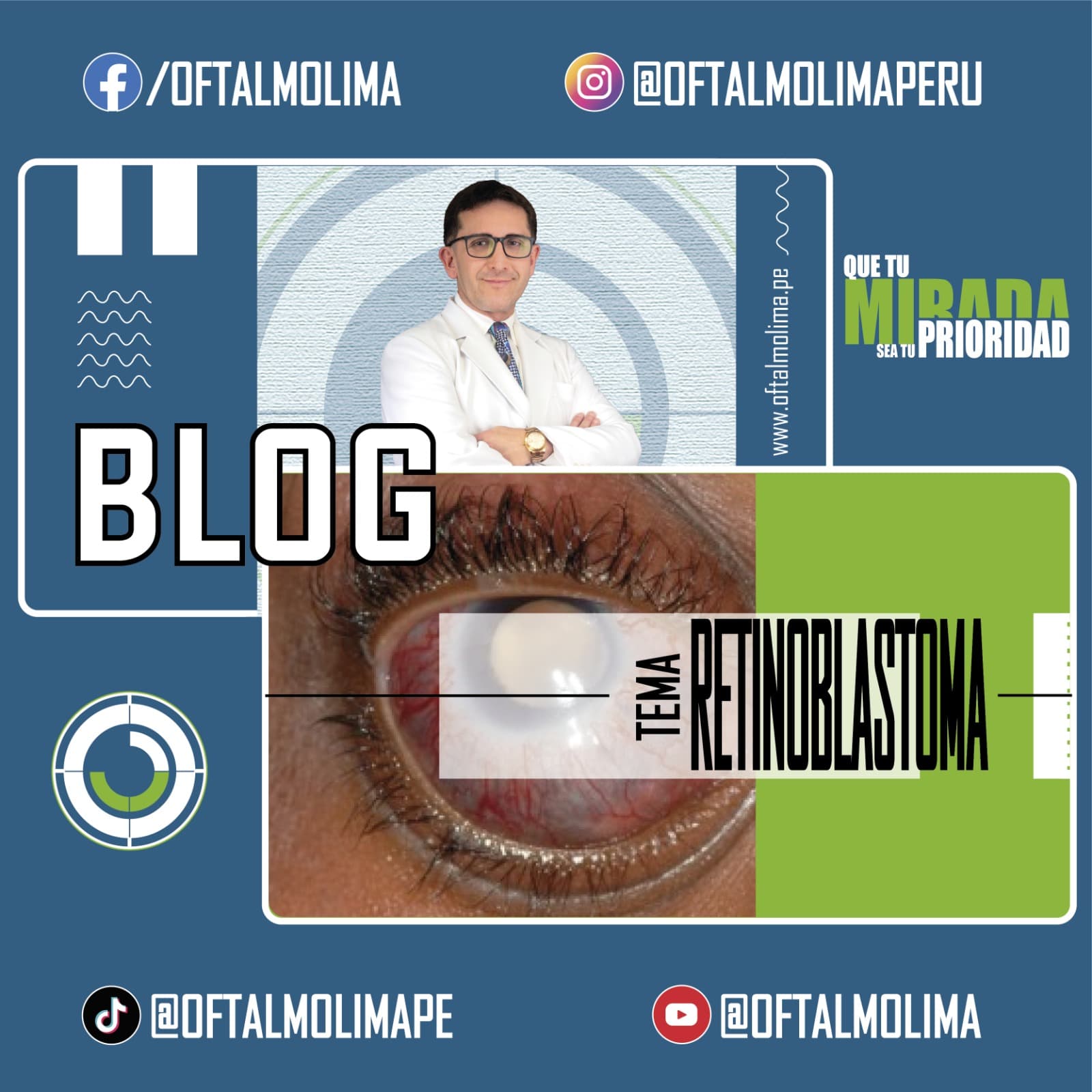 Retinoblastoma