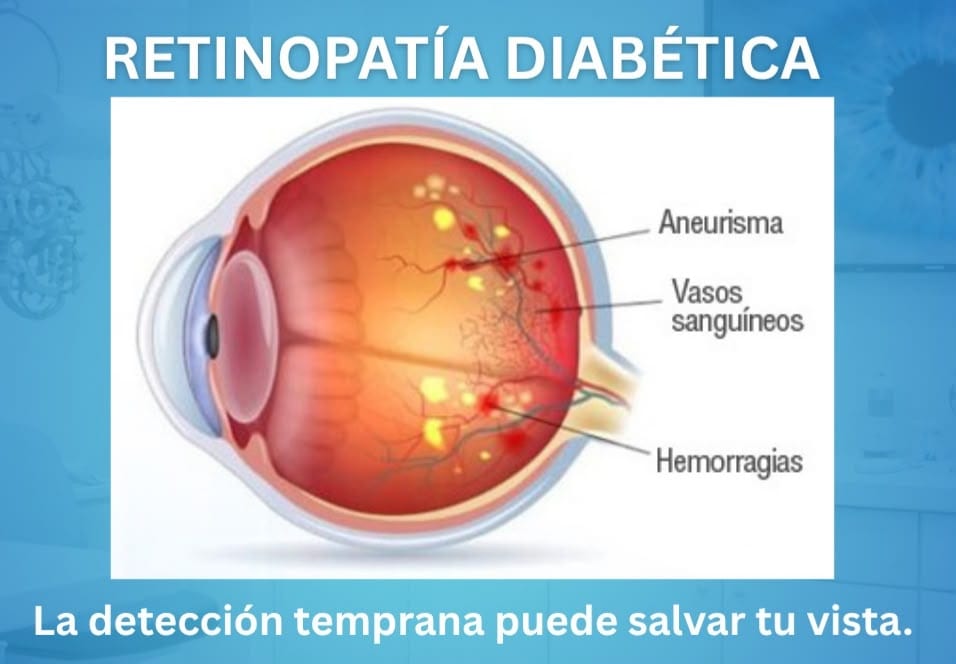retinopatia diabetica