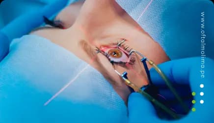 Consejos para el Cuidado de los Ojos durante la Temporada de Alergias