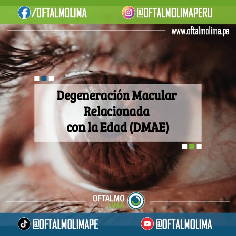 Degeneración Macular Relacionada con la Edad (DMAE): Causas, Síntomas y Tratamientos