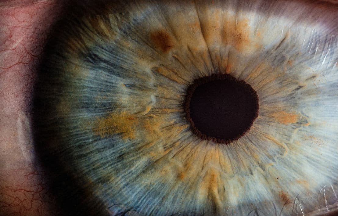 Entendiendo el Edema Macular y sus Tratamientos