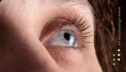 El queratocono: una afección ocular que requiere atención especializada