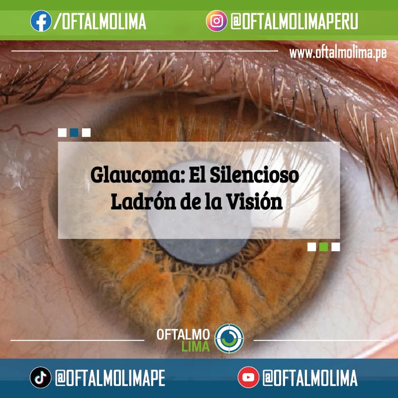 Glaucoma: El Silencioso Ladrón de la Visión