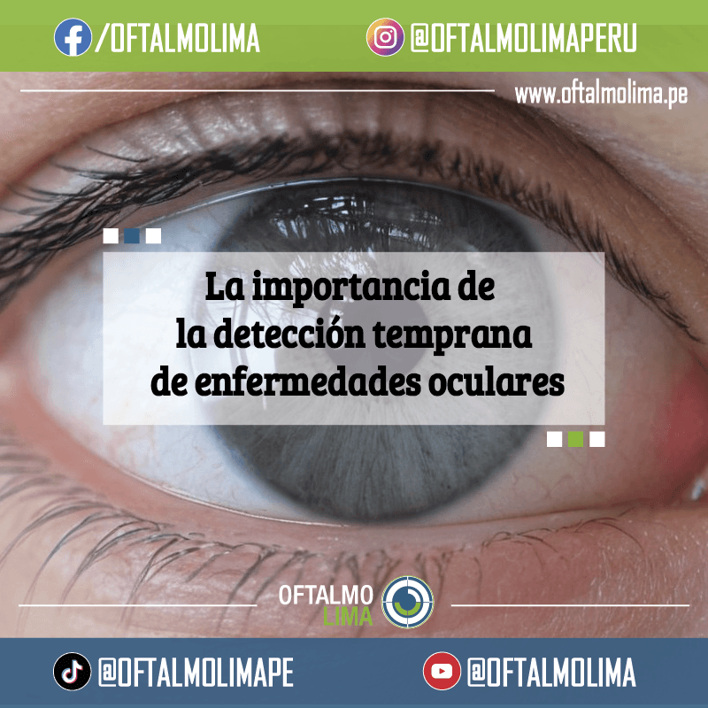 La importancia de la detección temprana de enfermedades oculares