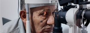 capsulotomia yag laser