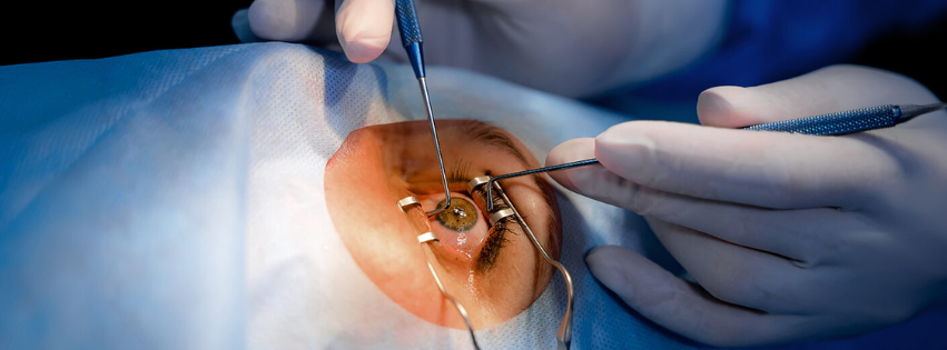 trasplante de cornea
